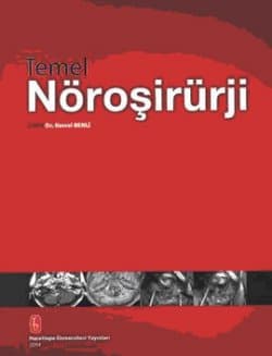 Temel Nöroşirürji