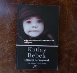 Kutlay Bebek Trizomi İle Yaşamak